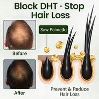 Follicure BioGrow Hair Restoration Spray 50 ml (Pack of 2)